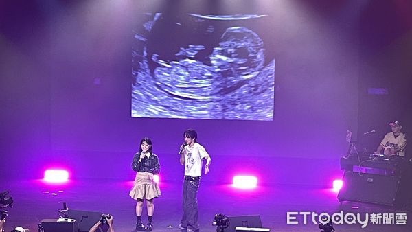 ▲▼ 婁峻碩和焦凡凡曬超音波照。(圖/記者翁子涵攝)