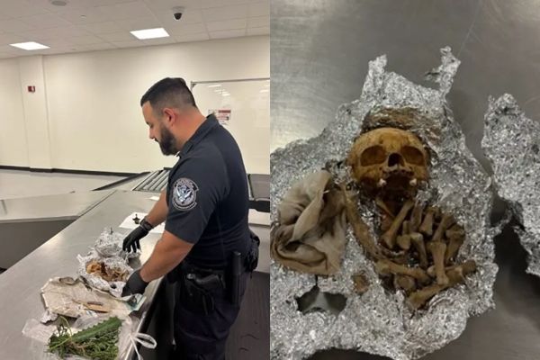 ▲▼行李藏「人類頭骨」企圖闖關美國機場!。(圖/Director of Field Operations)