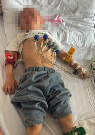 ▲▼都吃過同家三明治 貴州多人肝腎功能異常住院治療。(圖/翻攝極目新聞)