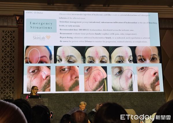 ▲王正坤醫師出席杜拜AMWC醫學美容大會,強調注射除皺安全與風險控管。(記者林東良翻攝,下同)