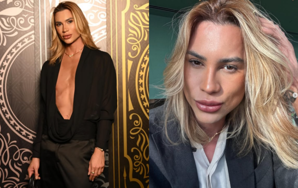 ▲▼ 巴西時尚網紅動刀「狐狸眼(fox eyes)」整形後死亡。(圖/翻攝自Instagram)