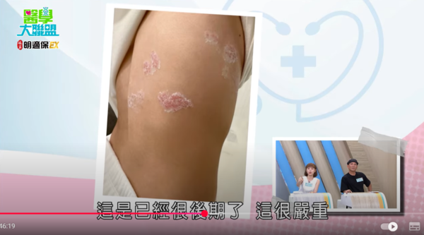 ▲▼畇二。(圖/翻攝自YouTube/醫學大聯盟)