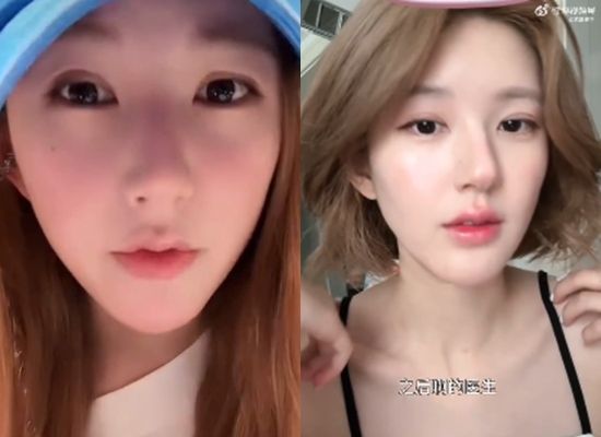 ▲趙露思難復工。(圖/翻攝自微博)