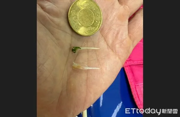 ▲衛生福利部臺中醫院急診科林記賢醫師說明,魚刺。(圖/記者游瓊華攝、台中醫院提供)