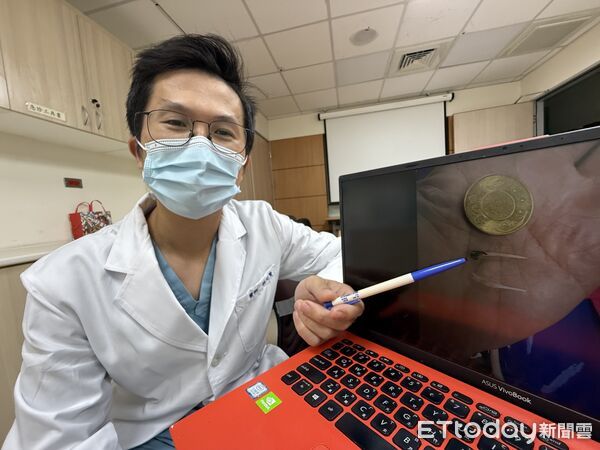 ▲衛生福利部臺中醫院急診科林記賢醫師說明,魚刺。(圖/記者游瓊華攝、台中醫院提供)