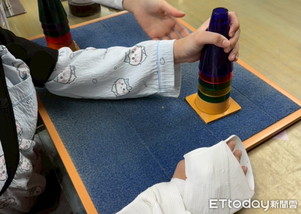 ▲限制誘發動作療法。(圖/衛福部南投醫院提供)