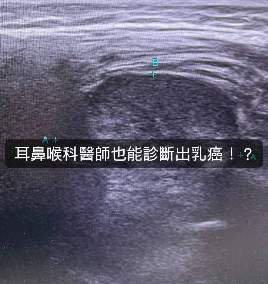 ▲一名四十多歲女子臉麻牙齦痛,竟是乳癌轉移。(圖/翻攝自耳鼻喉頭頸外科 張家豪醫師 臉書)