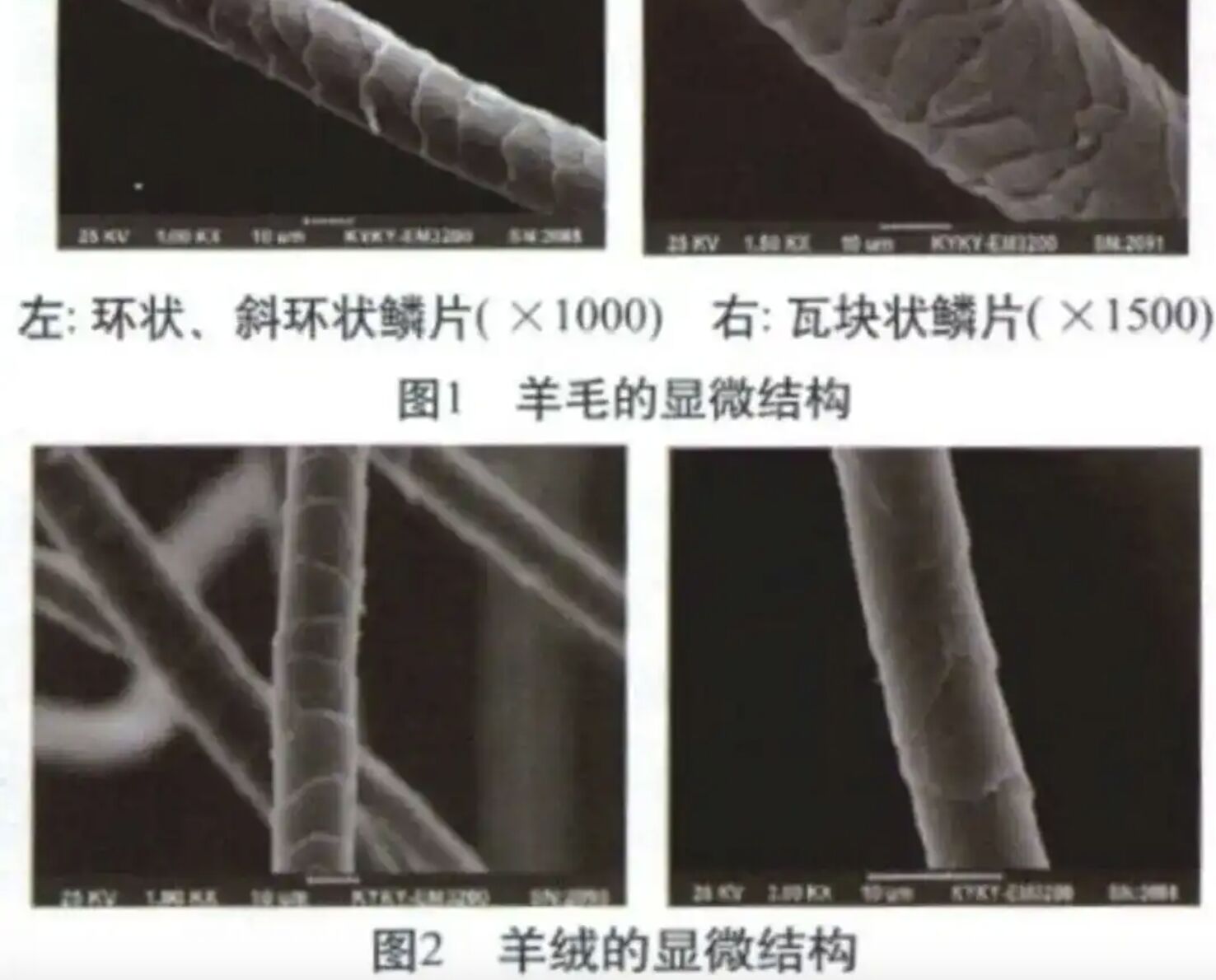 ▲部分群體對「高領衣物」過敏。(圖/翻攝中新網)