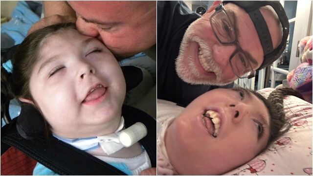 ▲▼「天生缺腦」被醫判活不到5歲! 她奇蹟慶祝20歲生日。(圖/翻攝Shawn Simpson )