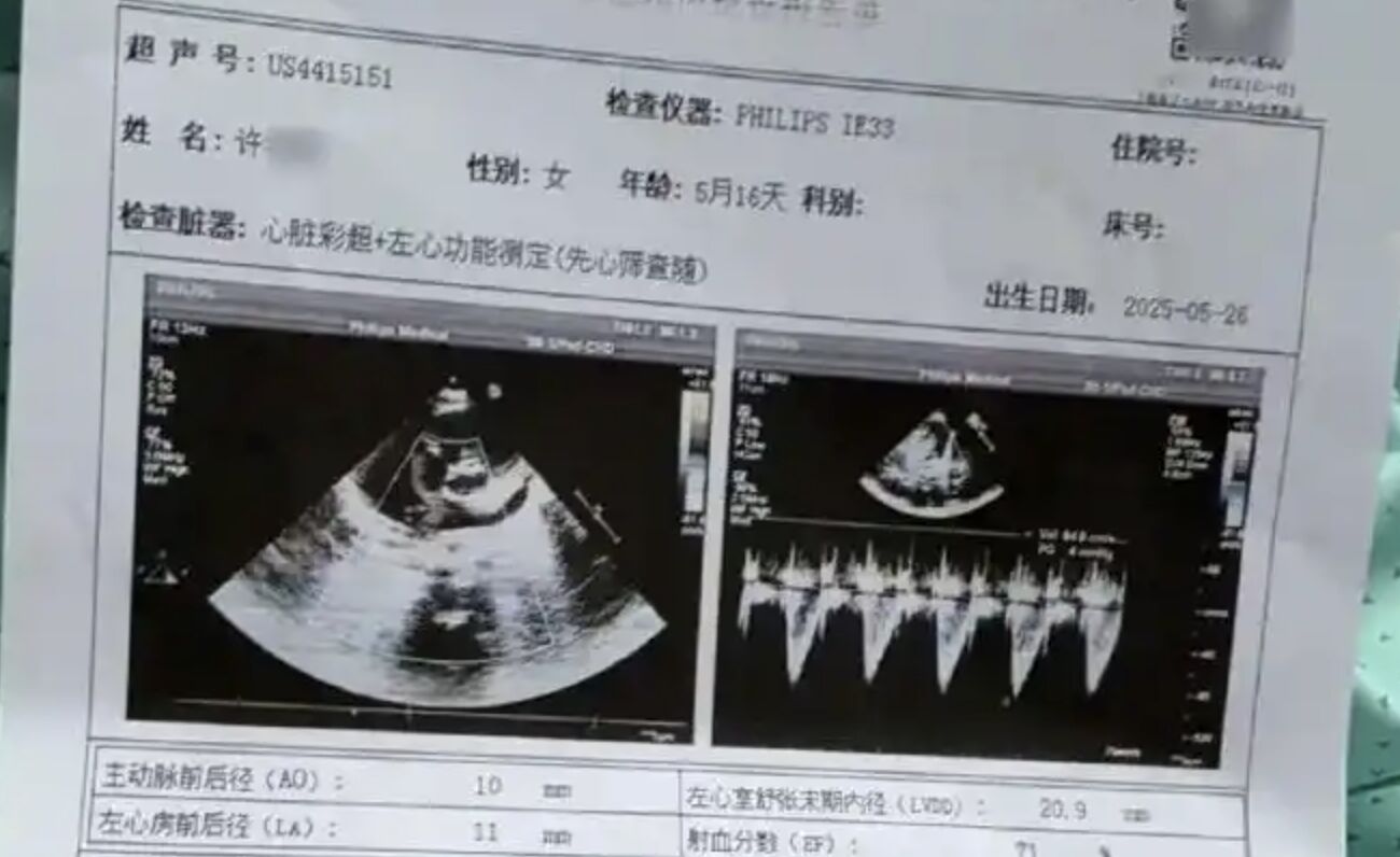 ▲寧波5個月大嬰兒「小洛熙」術後不治,家屬質疑醫院誤診。(圖/翻攝紅星新聞)