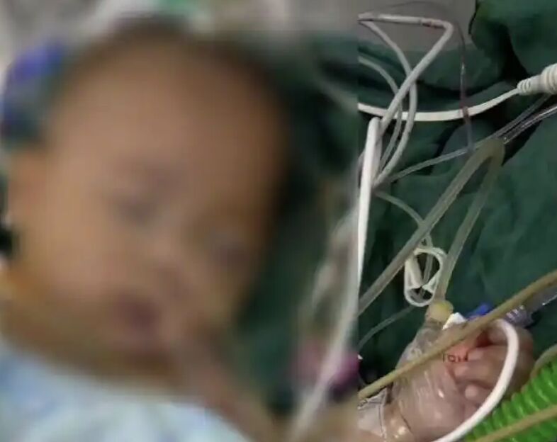 ▲寧波5個月大嬰兒「小洛熙」術後不治,家屬質疑醫院誤診。(圖/翻攝紅星新聞)