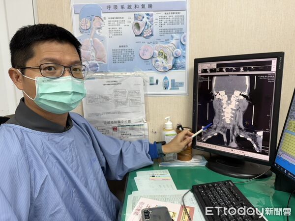 ▲沒有咳嗽也會得結核病,男子頸部腫大竟是肺外結核。(圖/衛福部南投醫院提供)