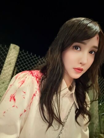 獨家/女星車禍毀容花500萬重建 十餘次手術換回新生