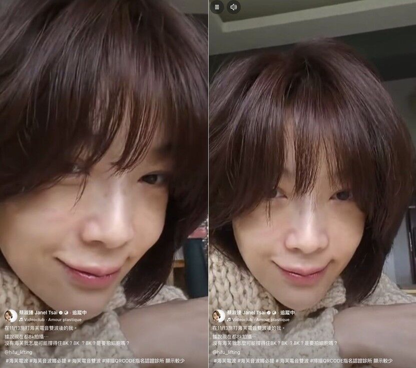 蔡淑臻,金馬獎,金馬紅毯,海芙電音雙波,媚必提,海芙音波,保養,醫美(圖/蔡淑臻臉書、海芙電音雙波官網)