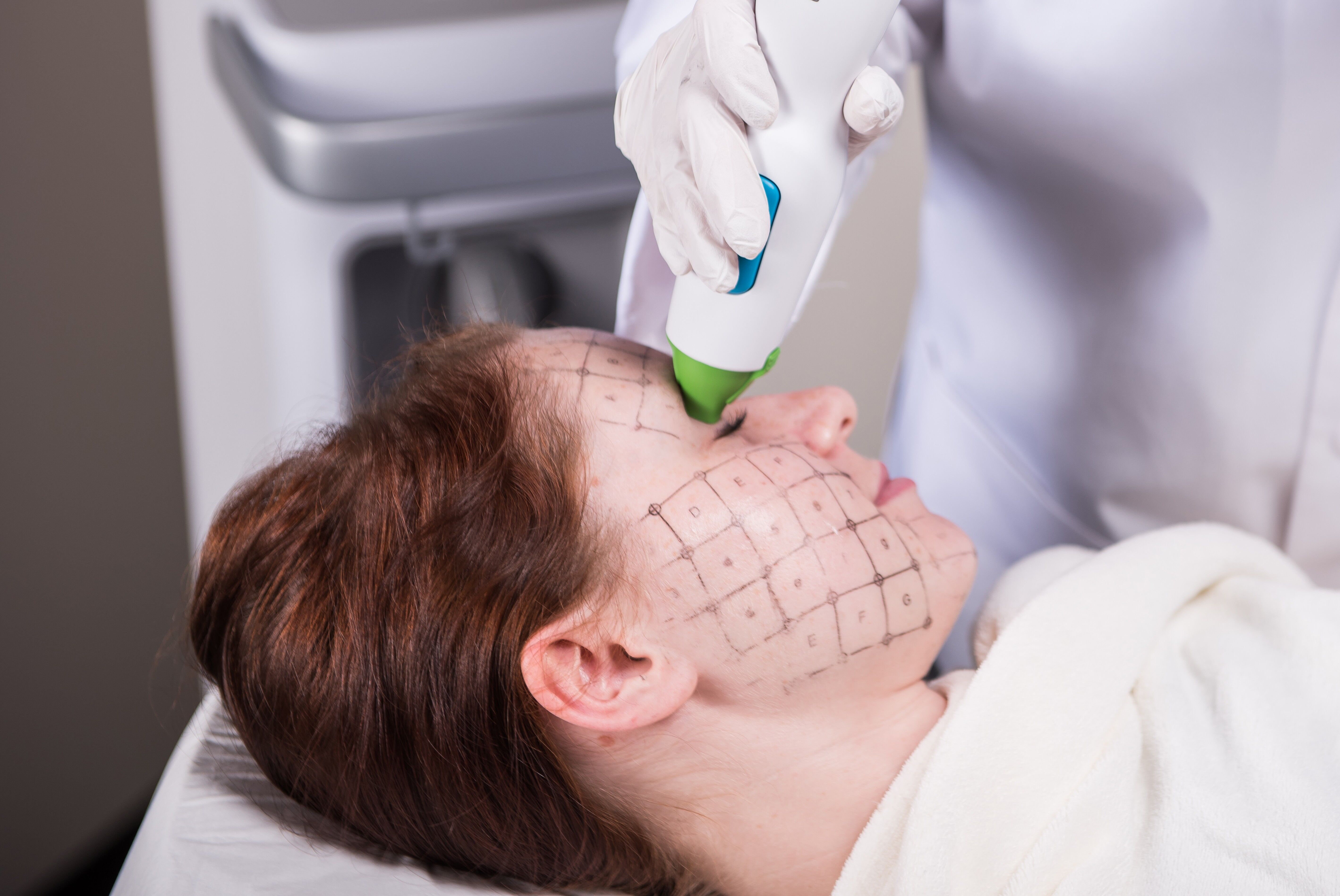 ▲▼醫美,鳳凰電波,原廠,探頭,拉提,專利,文獻,膠原蛋白,林心如,與時光逆行。(圖/業者提供)