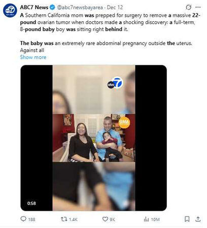 蘇茲康復後與丈夫及女兒團聚,表示每天都是上帝給的禮物。(圖/翻攝自X,@abc7newsbayarea)