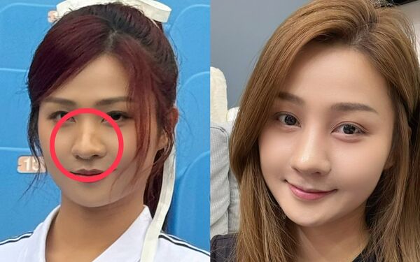 ▲▼左圖為二月拍廣告畫面,右圖為小紫術後照片。(圖/樂天桃猿提供)