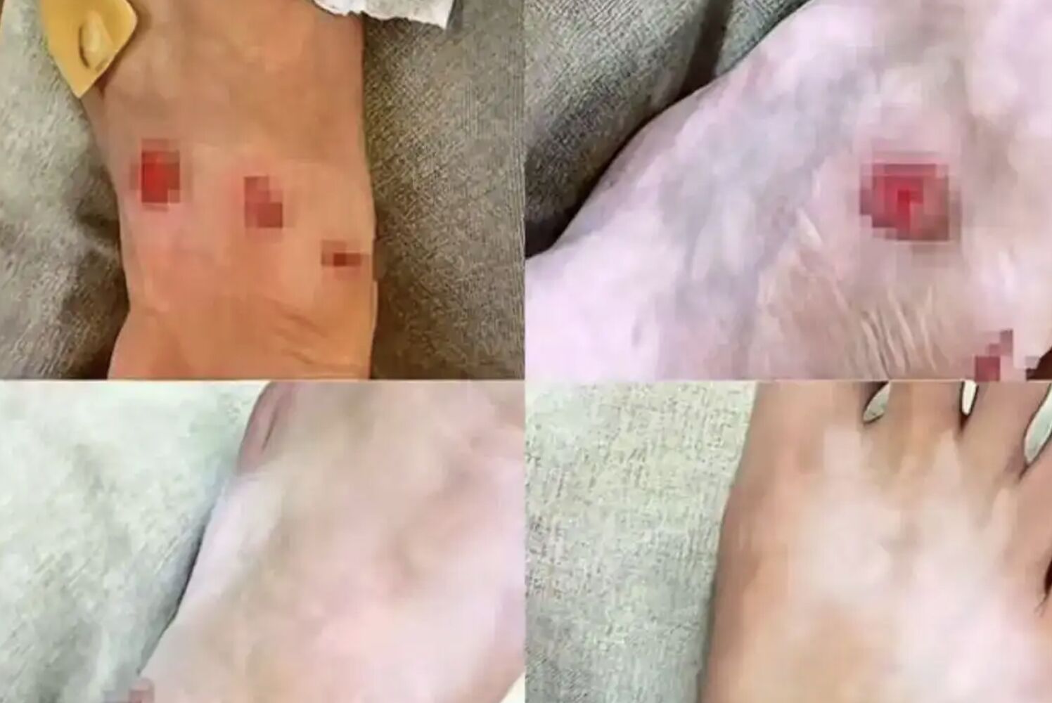 ▲上海一名女子穿LV運動鞋10分鐘便磨破腳,要求退貨被拒。(圖/翻攝每日經濟新聞)