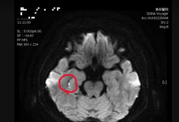 ▲榮醫療體系員榮醫院神經內科醫師陳彥秀,診斷出某位患者突發「短暫性全面失憶」 。(圖/員榮醫院提供)