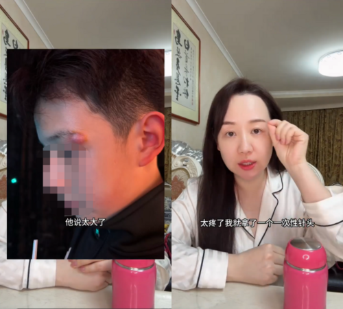 ▲▼關凌幫兒挑痘出事!害感染「進手術室縫4針」。(圖/翻攝自微博)