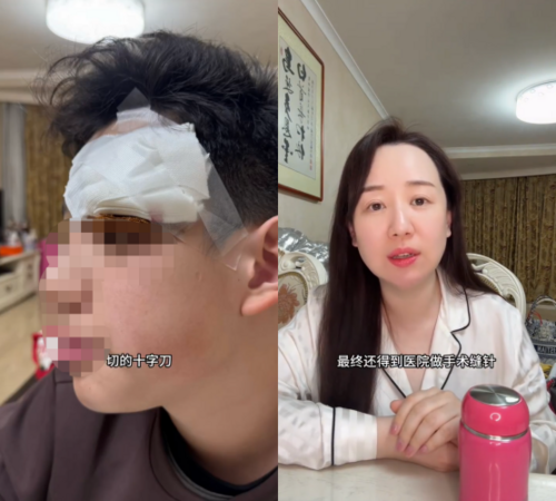 ▲▼關凌幫兒挑痘出事!害感染「進手術室縫4針」。(圖/翻攝自微博)