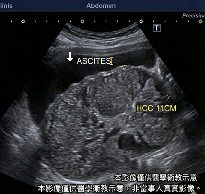 (示意圖/非當事人影像/卓韋儒醫師提供)