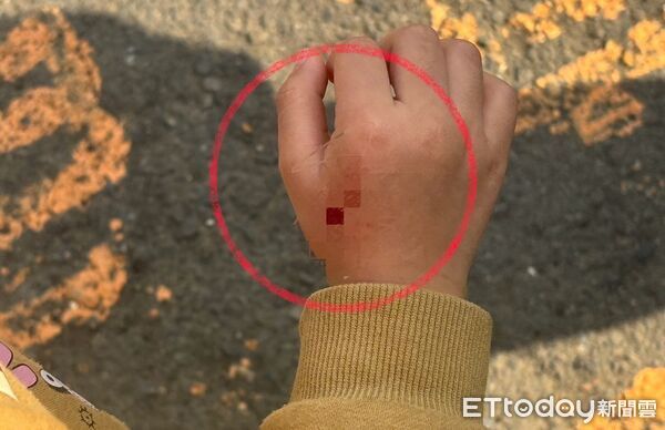 ▲▼4歲女童10日和家人逛台糖鳳山假日花市,被一隻綁在柱子旁的柴犬爆衝咬傷手。(圖/記者吳世龍攝)