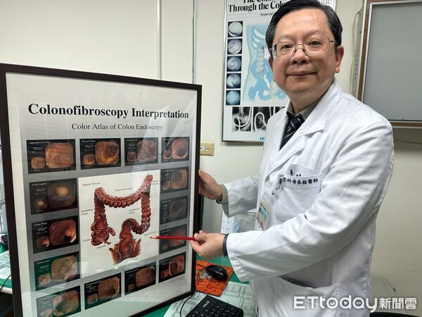 ▲腸內竟有一顆3公分大惡性腫瘤,猶如一顆乒乓球大小,趕緊安排腫瘤切除。(圖/豐原醫院提供)