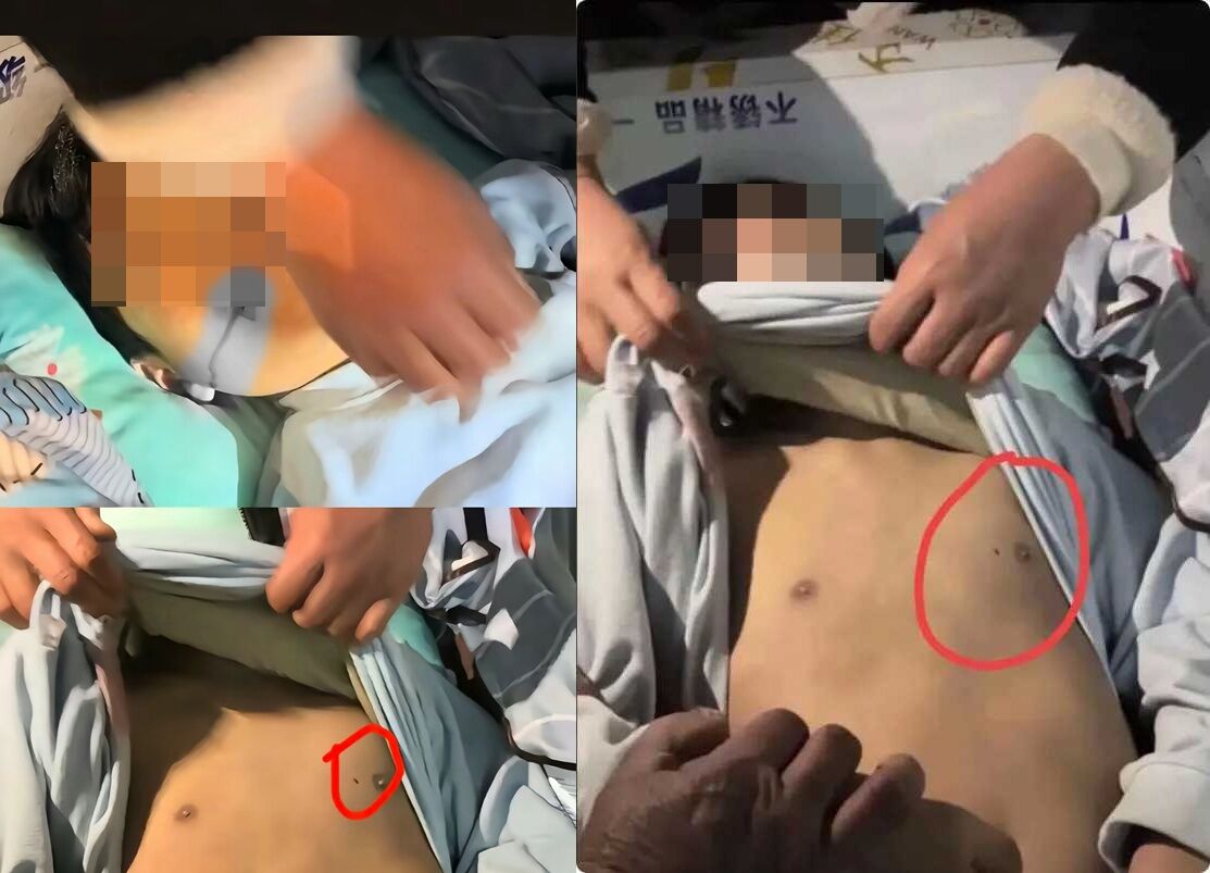 ▲河南13歲學生校園離奇死亡,遺體急轉移、胸口針孔引爆質疑。(圖/翻攝自微博)