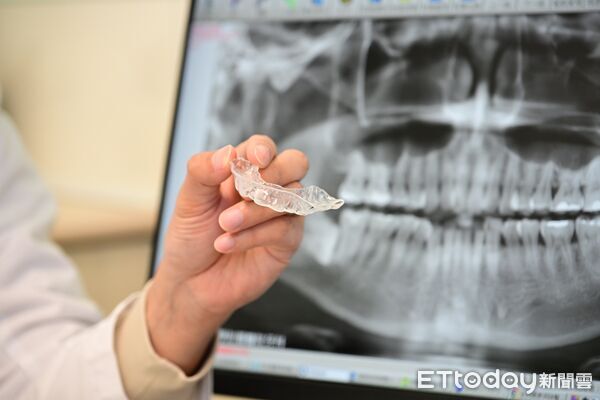 ▲楊晉瑜。(圖/亞大附醫提供)