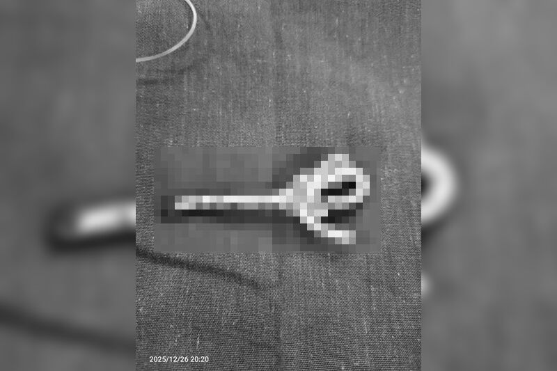 ▲▼越南少年將網路線插入尿道。(圖/翻攝臉書/Bệnh Viện Nhi Đồng TP Cần Thơ)