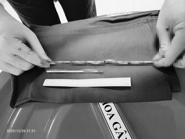 ▲▼越南少年將網路線插入尿道。(圖/翻攝臉書/Bệnh Viện Nhi Đồng TP Cần Thơ)