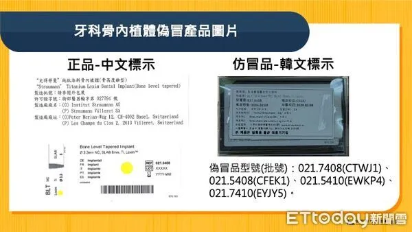 ▲▼ 植牙 。(圖/食藥署提供)