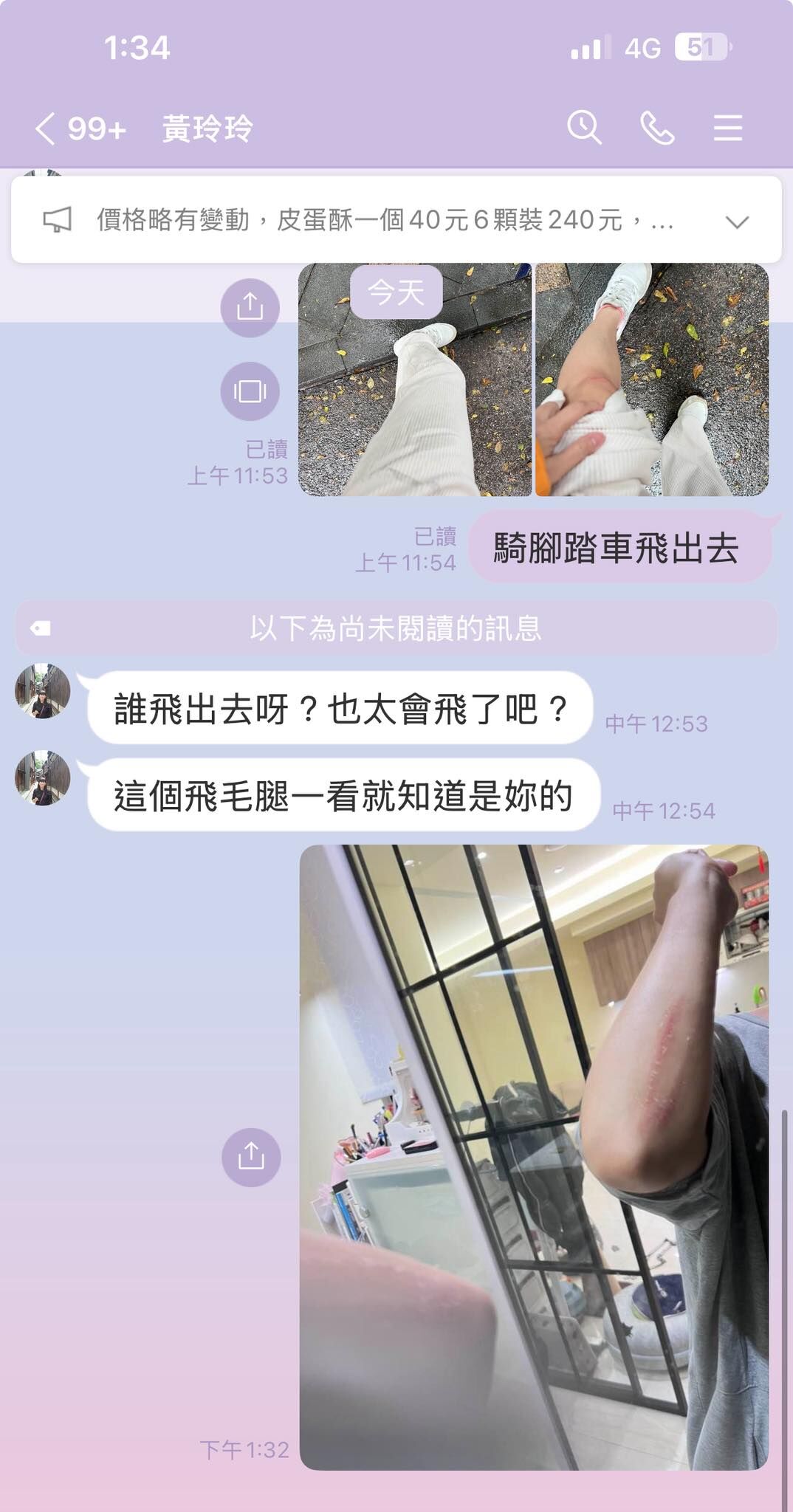 ▲▼米可白雨天騎車慘摔「整個人飛出去」 媽見傷照驚嘆:太會飛了吧。(圖/翻攝自Facebook/米可白)