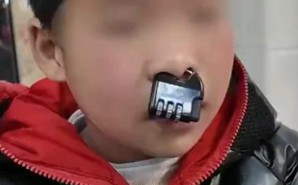 ▲▼ 大陸湖南男孩玩鎖卡鼻變牛魔王 。(圖/翻攝 網易)