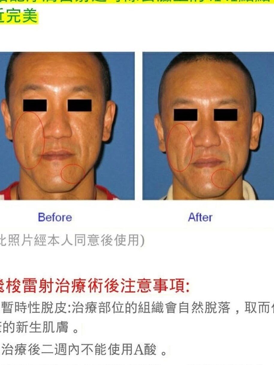 ▲▼醫美模特雖然有打馬賽克,仍被認出是陳為民。(圖/翻攝Threads)