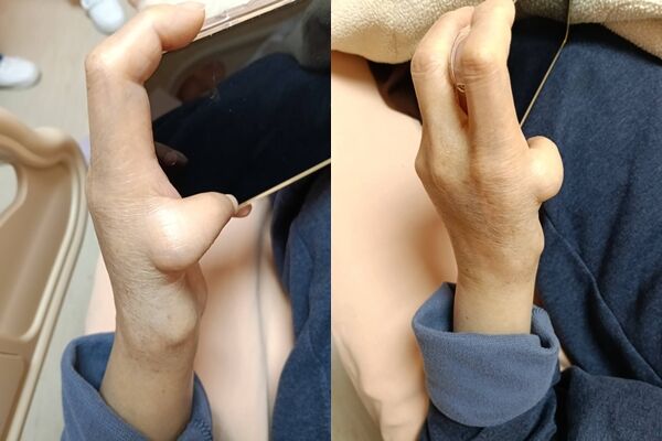 ▲該病症為「范可尼貧血」。(圖/翻攝自臉書/蘇一峰)