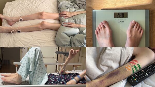 ▲有病長壽女孩不幸癌逝。(圖/翻攝自韓網)