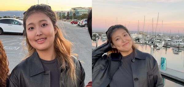 ▲▼《單身地獄》洪真慶15歲女遭疑削骨整型 媽崩潰揭真相。(圖/翻攝自Instagram/jinkyunghong)