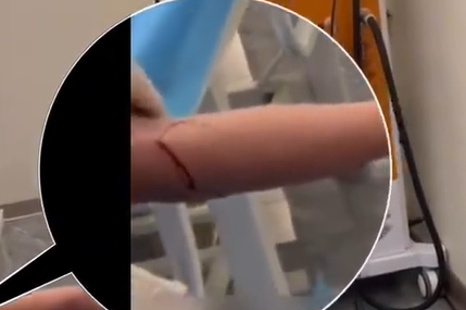 ▲店家聲稱單次須放血100毫升。(圖/翻攝自微博)