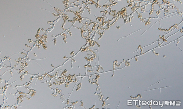▲▼ 掃帚黴菌 。(圖/林冠吟提供)