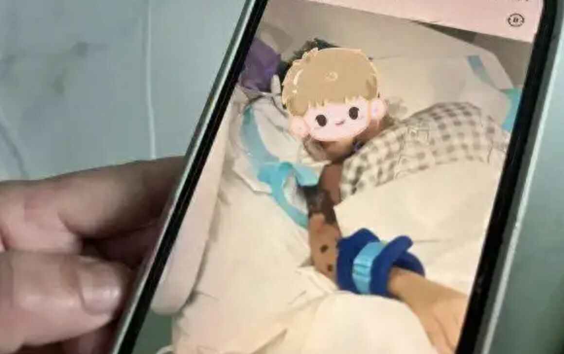 ▲津津(化名)送醫搶救時,手臂上已出現明顯黑斑。(圖/翻攝長江日報)