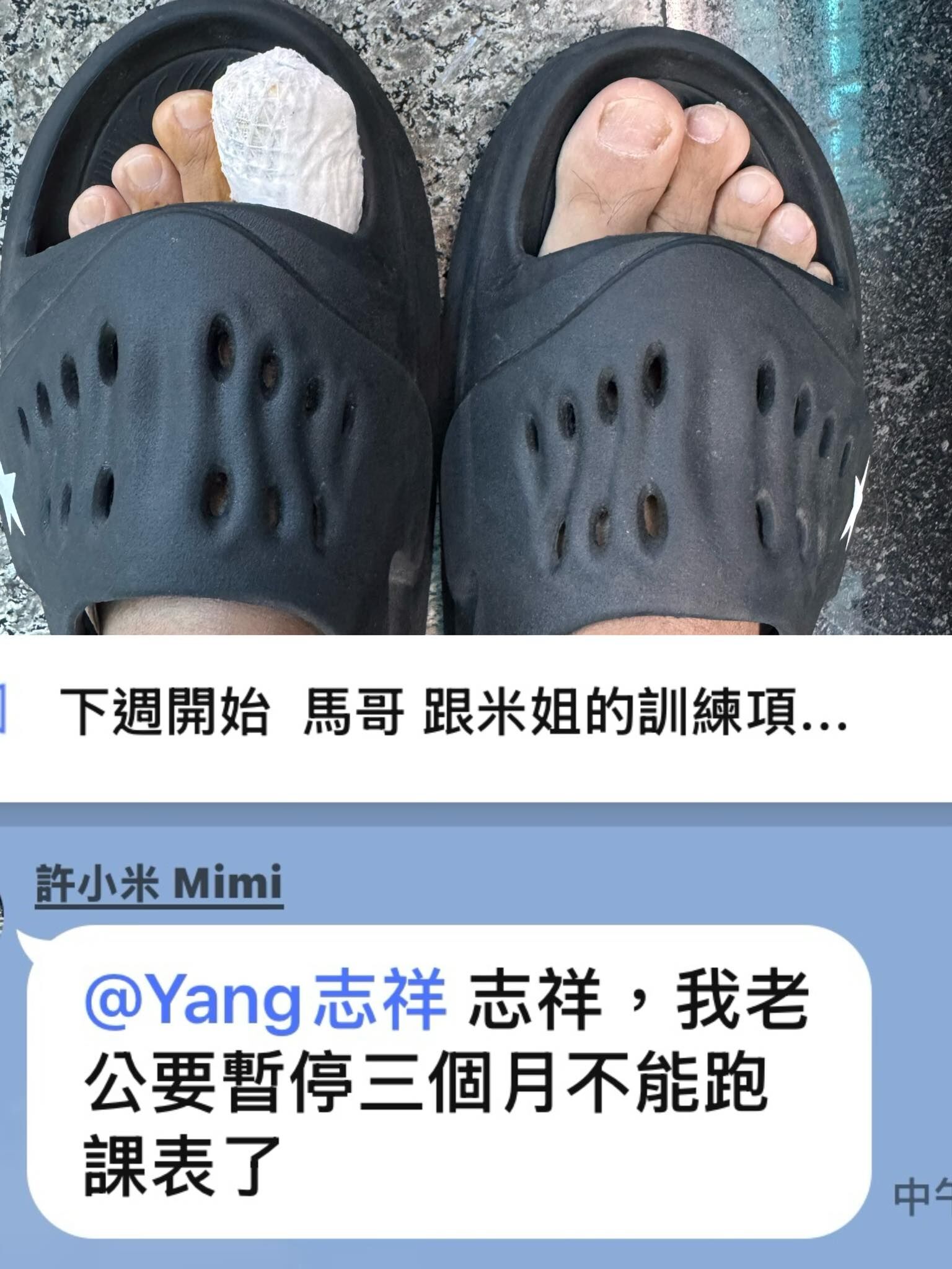 ▲▼手機砸中大拇趾竟骨裂!小馬驚悚包紮照曝光。(圖/翻攝自臉書)