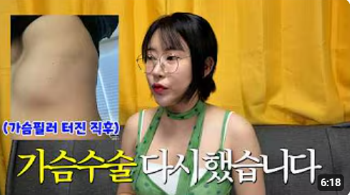 ▲李世英隆乳大走山。(圖/翻攝自YouTube/영평티비 YPTV)