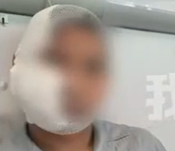 ▲包律師遭鯊魚毀容。(圖/翻攝自微博)