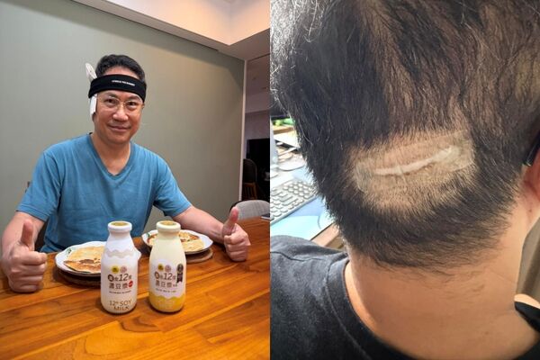 ▲▼楊月娥家中深夜傳巨響! 驚見「老公摔破頭」傷照曝:手掌都是血。(圖/翻攝自Facebook/楊月娥)