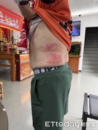 ▲台南市議員郭鴻儀前往仁德區易淹水熱點勘災,協助處理遭水壓頂開的人孔蓋時不慎跌入箱涵,造成腰側、膝蓋等處有多處擦傷,非常驚險。(台南市議員郭鴻儀提供,下同)