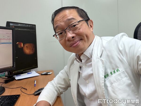 ▲▼以為是胃痛!38歲女剖出「130顆玉米狀結石」 醫示警:8成沒症狀。(圖/黃漢斌醫師授權提供,未經同意請勿任意翻攝)