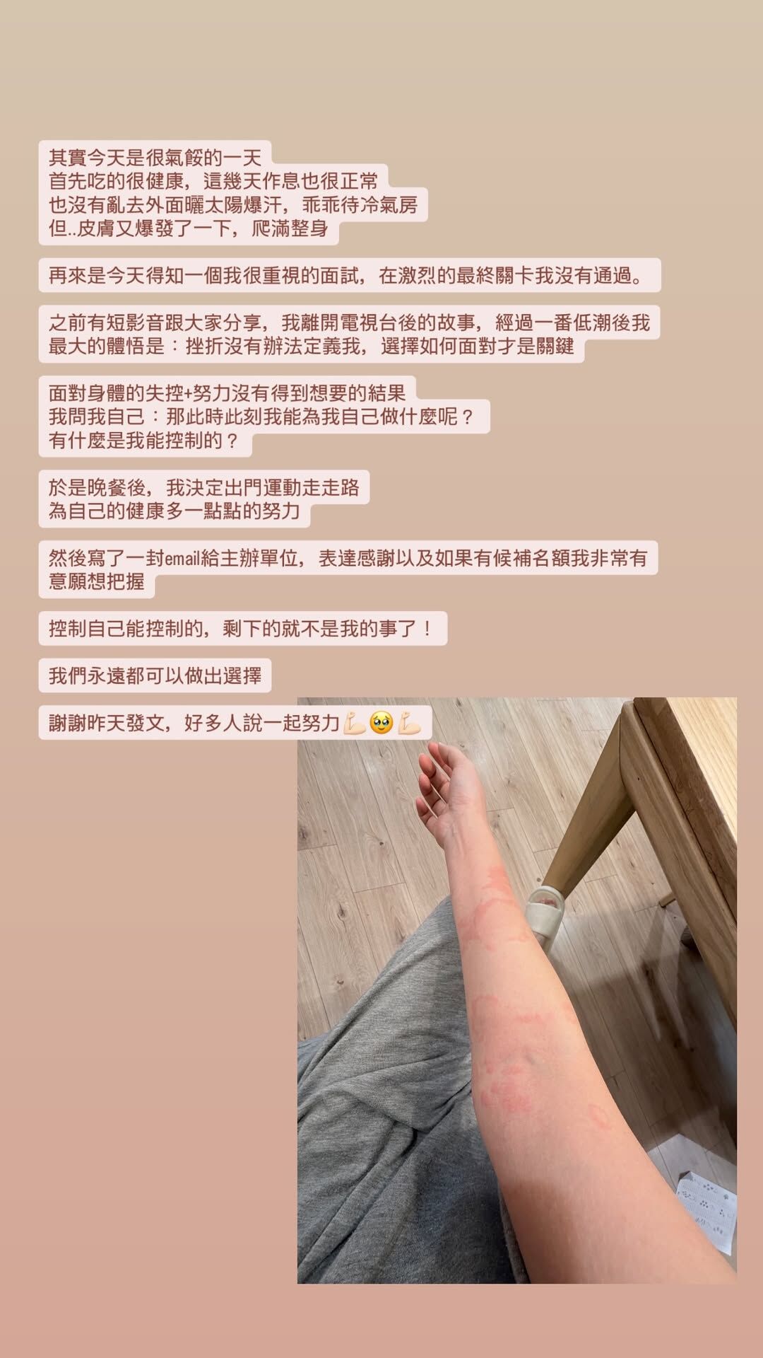 ▲▼優格姐姐蕁麻疹又復發!面試落選遭雙重打擊。(圖/翻攝自Instagram/yogurtlin1010)