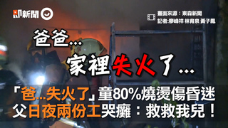 「爸...失火了」童80%燒燙傷昏迷　父日夜兩份工哭癱：救救我兒！